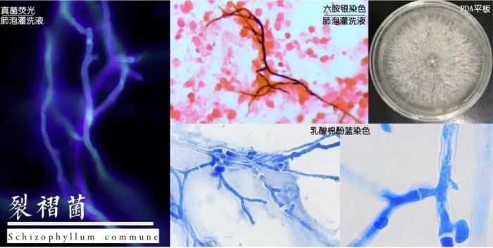 曲霉菌與裂褶菌孢子可能隨空氣飄散進入人體肺部。（圖／翻攝自極目新聞）