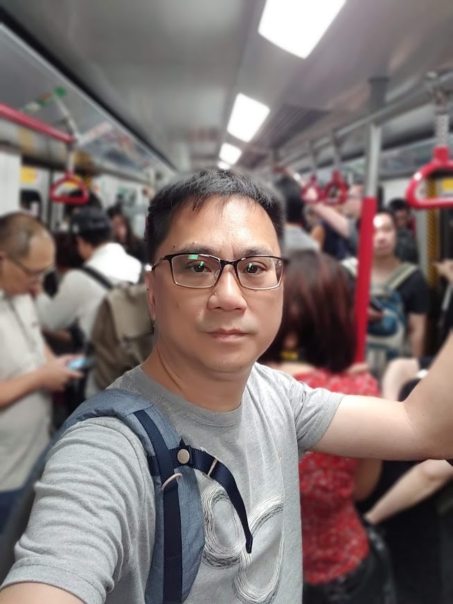 不到40歲洗腎男臉超黑!486先生一問「竟是糖尿病友」 親揭保命妙招