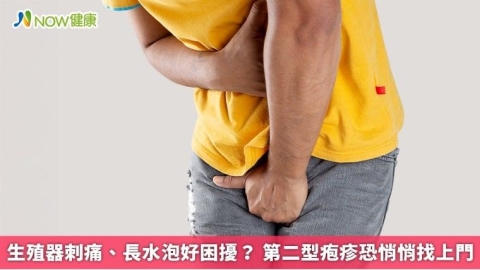 生殖器刺痛、長水泡好困擾? 第二型疱疹恐悄悄找上門