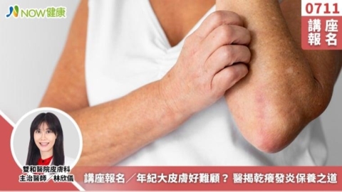 講座報名／年紀大皮膚好難顧？ 醫揭乾癢發炎保養之道