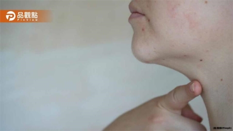 中醫師揭密！下巴爆痘、水腫暴增竟是婦科警訊