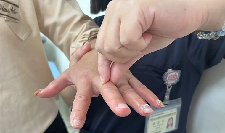 乳癌術後手腫痛？ 醫揭「淋巴水腫」與一般水腫大不同