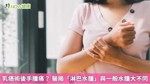 乳癌術後手腫痛？ 醫揭「淋巴水腫」與一般水腫大不同