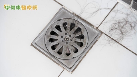 洗完頭發現排水孔都是頭髮？中醫解析4大掉髮類型　圓形禿別輕忽