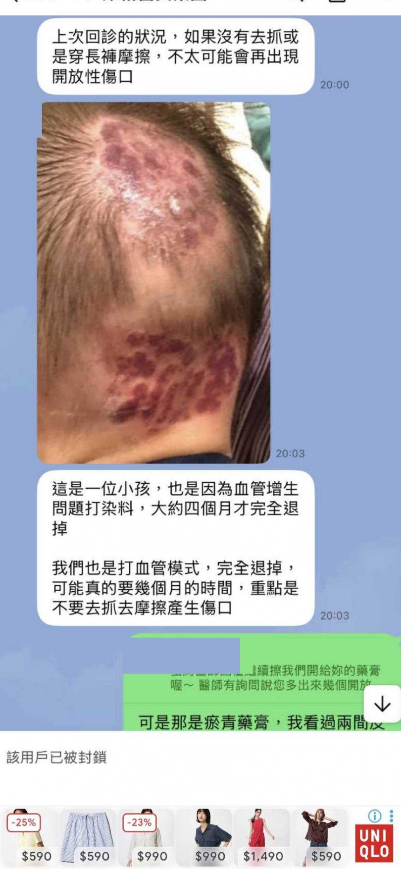 維格診所在珍妮術後出問題，LINE了一個小孩頭部血管打染料的照片，表示一切正常。（圖／讀者提供）