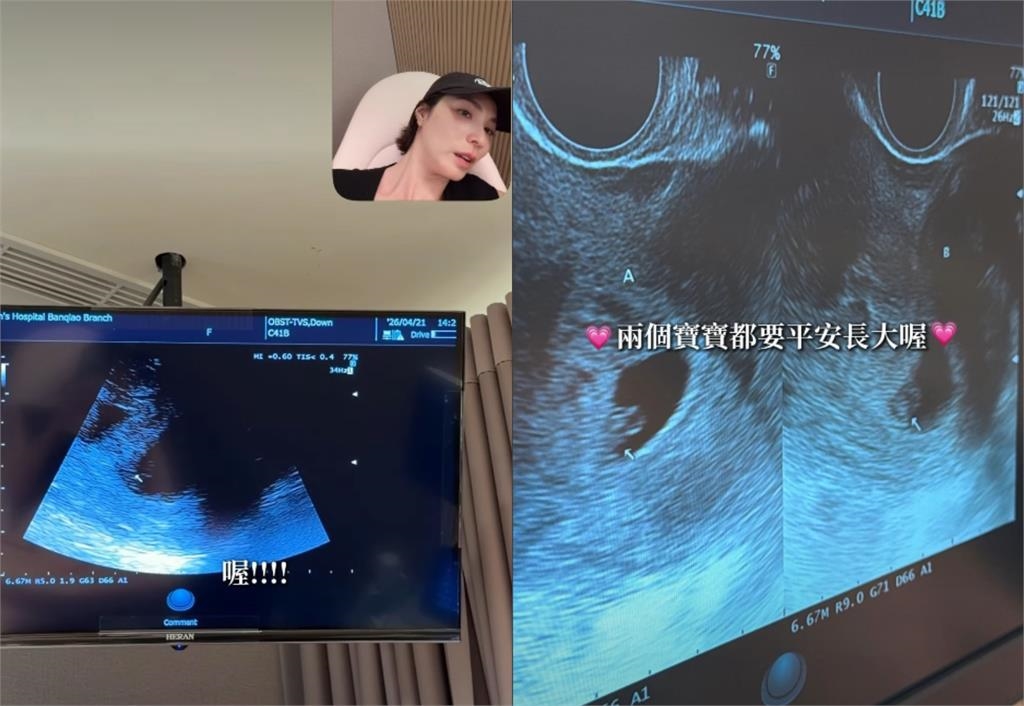 43歲台劇女星「懷雙胞胎6週」首聽心跳暴淚！醫揭「音異真相」她哭炸：幸福的聲音
