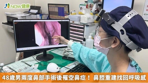 48歲男兩度鼻部手術後罹空鼻症! 鼻腔重建找回呼吸感