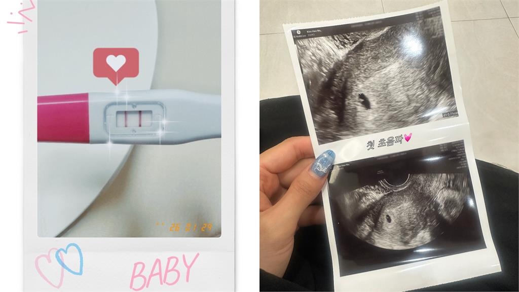 啦啦隊女神閃嫁再丟震撼彈!她曬「驗孕棒、超音波圖」藏半年突曝將當媽