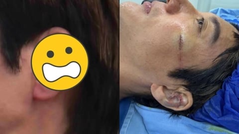 王力宏人在中國「耳骨撞碎」驚悚畫面曝!證實「重摔縫39針」文末預告1事
