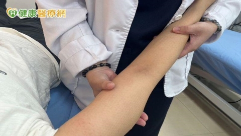 乳癌術後手臂淋巴水腫 醫師教簡易自我檢測與退腫處置