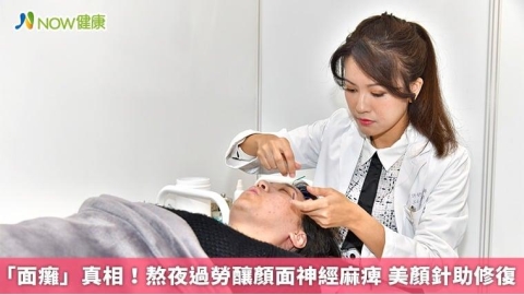 「面癱」真相!熬夜過勞釀顏面神經麻痺 美顏針助修復