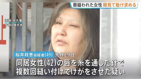 嘴唇被同居人用針線縫死! 日女逃到超商靠紙條「請救救我」求救