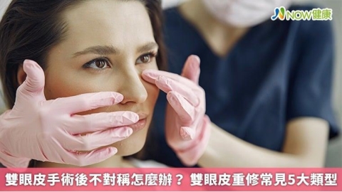 雙眼皮手術後不對稱怎麼辦? 雙眼皮重修常見5大類型
