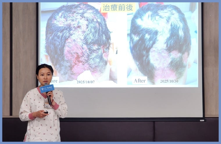傷口真的不能碰水? 奇美傷口照護中心破解癌症皮膚毒性照護盲點