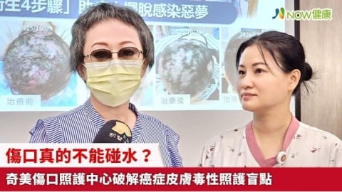 傷口真的不能碰水? 奇美傷口照護中心破解癌症皮膚毒性照護盲點