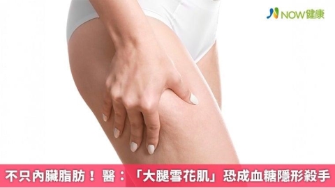 不只內臟脂肪! 醫:「大腿雪花肌」恐成血糖隱形殺手