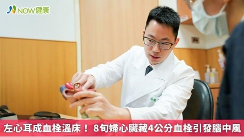 左心耳成血栓溫床！ 8旬婦心臟藏4公分血栓引發腦中風