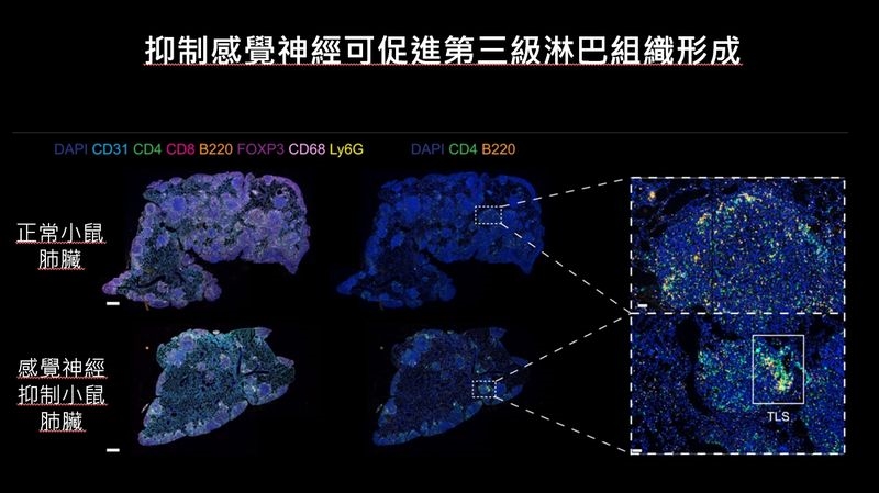 讓癌細胞「斷電」?臺大研究揭感覺神經與腫瘤生長有關 盼成肺癌治療新方向