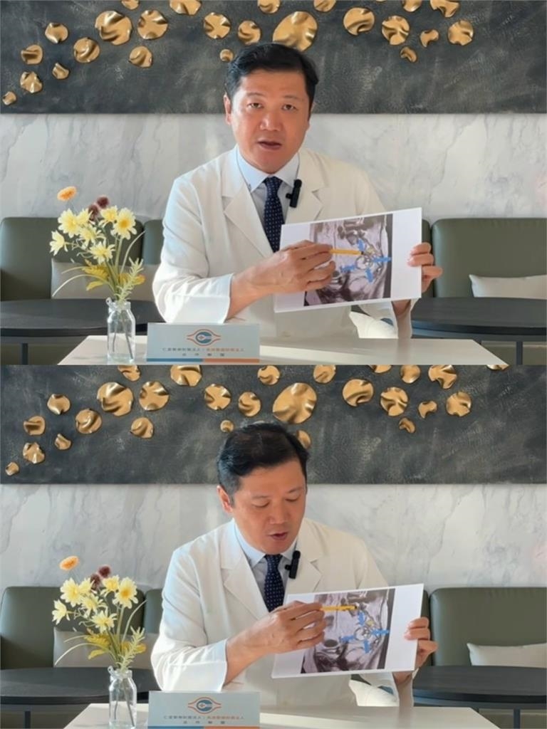 婦肛門劇痛半年只能臥床!驚見直腸後「罕見腫瘤」 醫曝:恐與遺傳肥胖相關