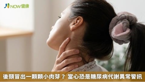 後頸冒出一顆顆小肉芽? 當心恐是糖尿病代謝異常警訊