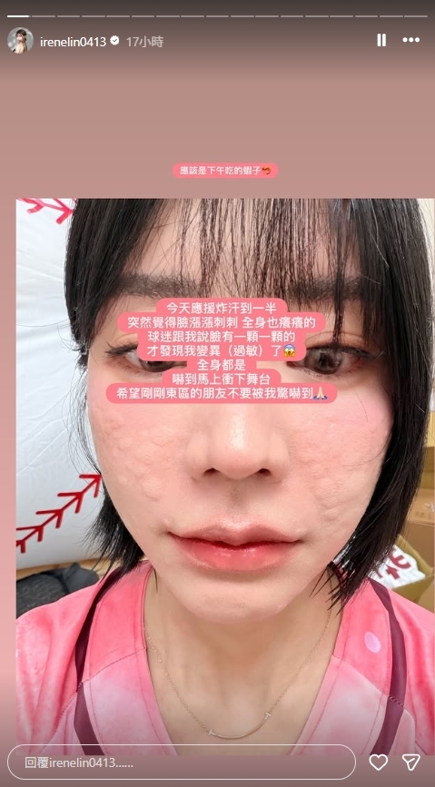 「中職最正MC」應援一半「突滿臉冒顆粒」嚇到衝下台!臉蛋全毀近照流出