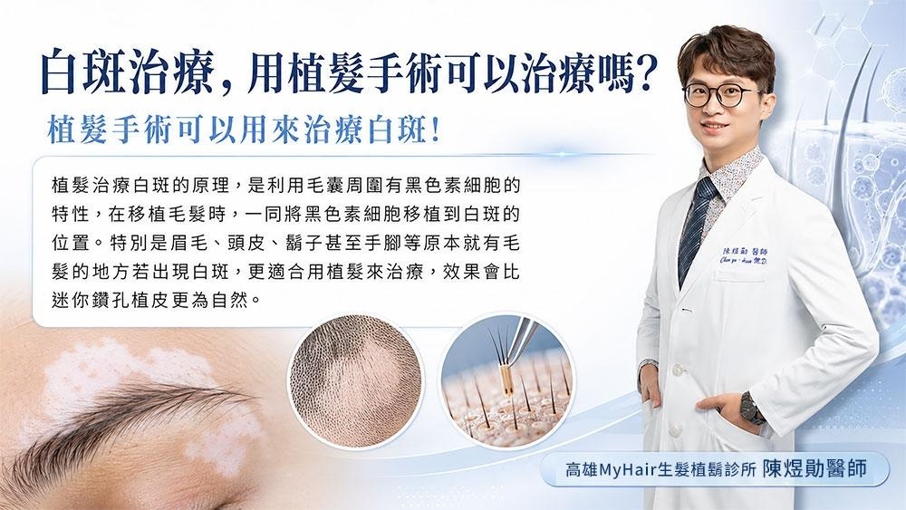 白斑治療新選擇?醫師解析植髮手術於特定情況的臨床應用