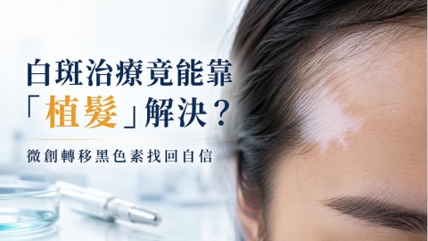 白斑治療新選擇？醫師解析植髮手術於特定情況的臨床應用