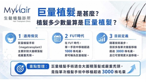 巨量植髮如何應用於大範圍落髮?醫師解析取髮條件與費用評估