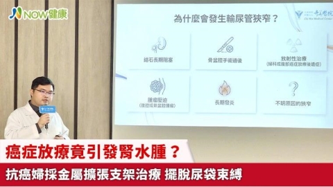 癌症放療竟引發腎水腫？抗癌婦採金屬擴張支架治療 擺脫尿袋束縛