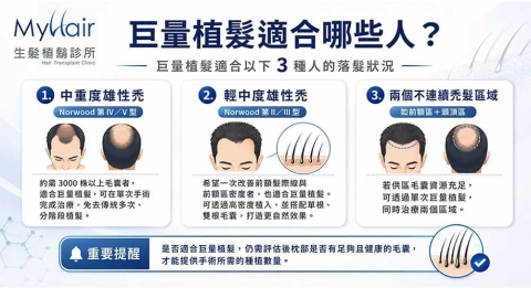 巨量植髮適合哪些人？醫師解析三大落髮族群與療程評估重點