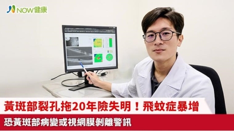 黃斑部裂孔拖20年險失明!飛蚊症暴增 恐黃斑部病變或視網膜剝離警訊