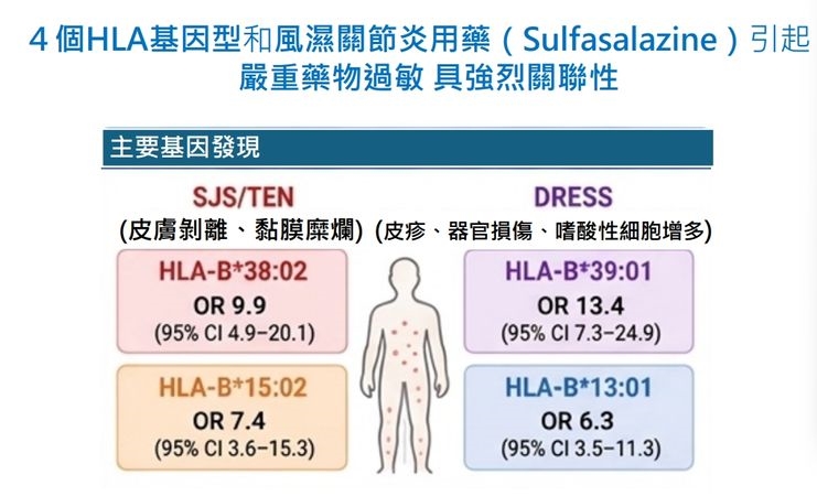 1關節炎藥嚴重過敏發生率約0.4% 長庚研究揭「關鍵基因」盼助提前預防