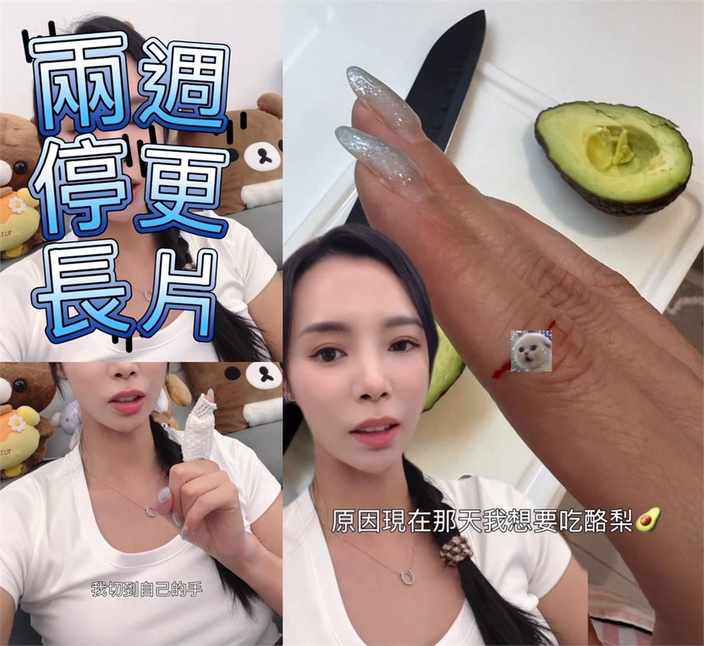 舞蹈女神驚傳手指「爆開」！茵茵自曝送急診縫3針　急宣頻道停更兩周