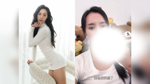 舞蹈女神驚傳手指「爆開」!茵茵自曝送急診縫3針 急宣頻道停更2周