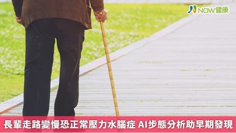 長輩走路變慢恐正常壓力水腦症 AI步態分析助早期發現