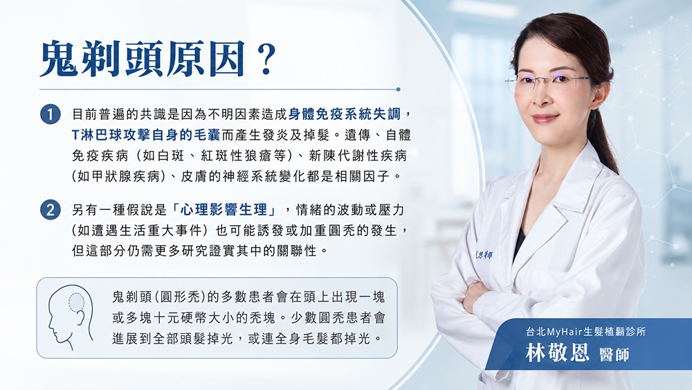 鬼剃頭一定是壓力太大嗎？醫師解析圓形禿原因與就醫警訊