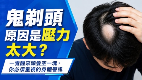 鬼剃頭一定是壓力太大嗎？醫師解析圓形禿原因與就醫警訊