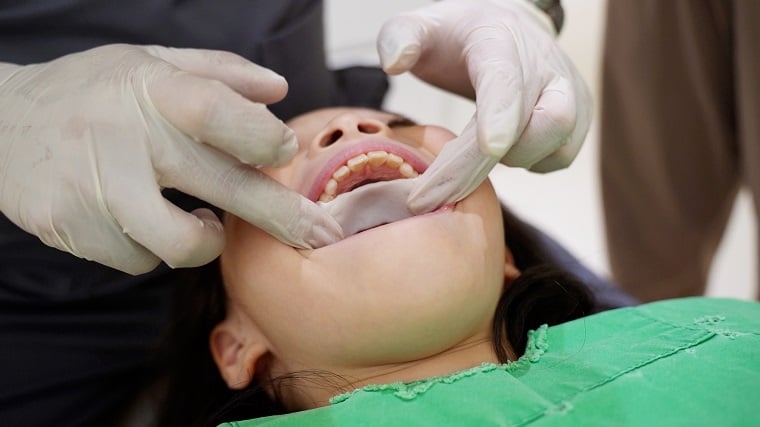 孩子鼻塞黑眼圈問題在顎骨？ 活動式牙弓擴張器助改善