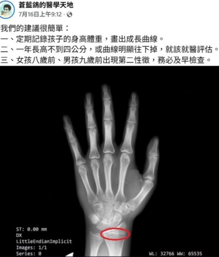 男生能長到成年?15歲男童身高卡關檢查驚見「這1危機」 醫列3大警訊:應及早就醫