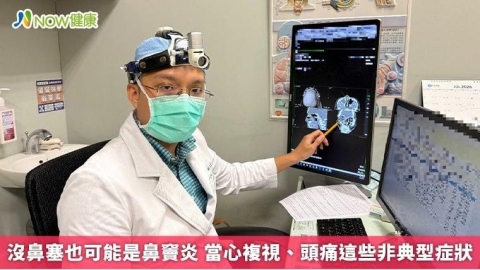 沒鼻塞也可能是鼻竇炎 當心複視、頭痛這些非典型症狀