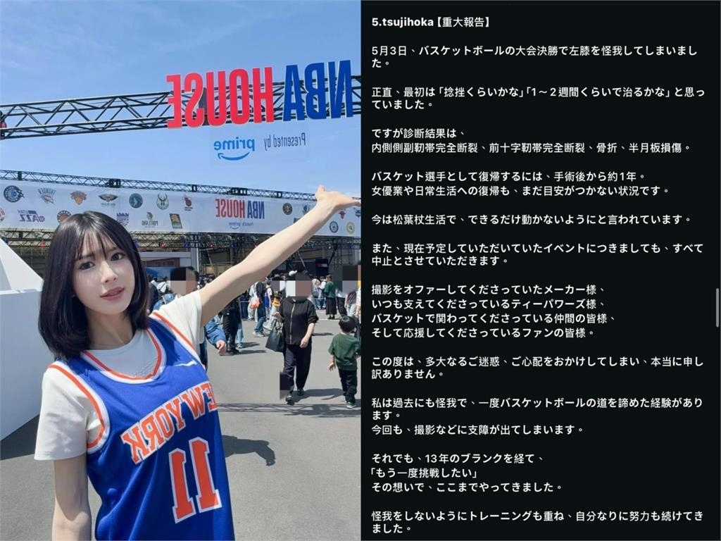 暗黑女優宣布回歸!昔雙韌帶「打到斷掉」傷勢慘重…停工數月復出時間曝光