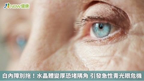 白內障別拖!水晶體變厚恐堵隅角 引發急性青光眼危機