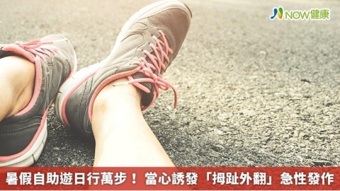 暑假自助遊日行萬步！ 當心誘發「拇趾外翻」急性發作
