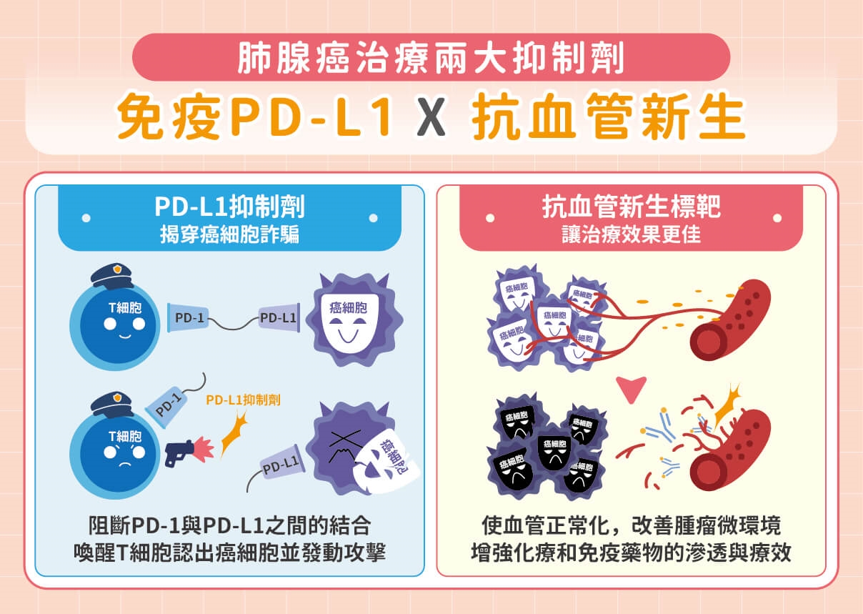 肺癌無基因突變？免疫＋抗血管新生抑制劑，轉移也有機會控制病情！