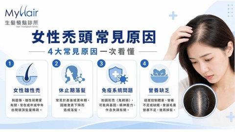 狂掉髮好焦慮?女性禿頭原因有哪些?醫師解析4大常見成因