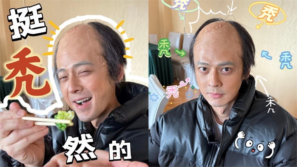昔赴中國尋根脫口爆「在台灣靈魂沒回家」!台灣男星「突變大禿頭」近況認不出