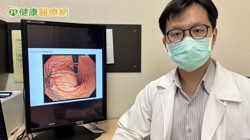 檢查沒潰瘍!50歲男左上腹悶痛半年竟是胃腸道基質瘤 醫解治療重點