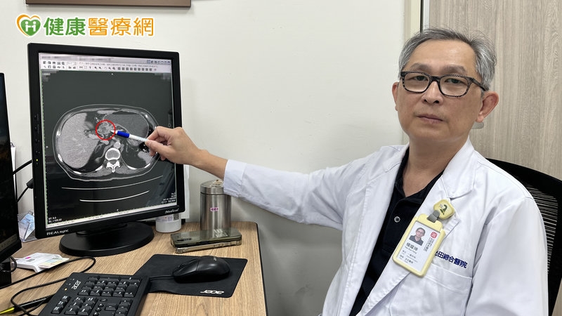 胃脹氣、消化不良拖半年！68歲男一照竟是胃癌第3期　醫揭兇手