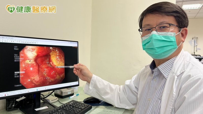 胃脹氣、消化不良拖半年！68歲男一照竟是胃癌第3期　醫揭兇手