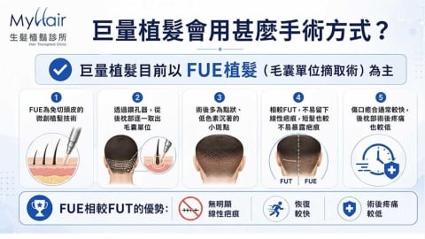 大範圍植髮怎麼進行?醫師解析 FUE 取髮方式與術前評估重點